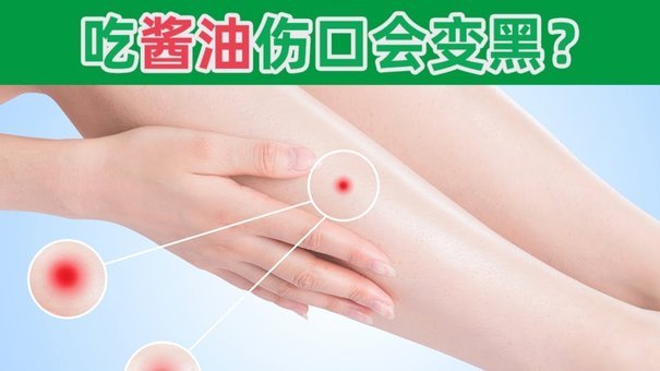 奥莱：伤病情况复杂，阿根廷预计本月底才会公布最终名单